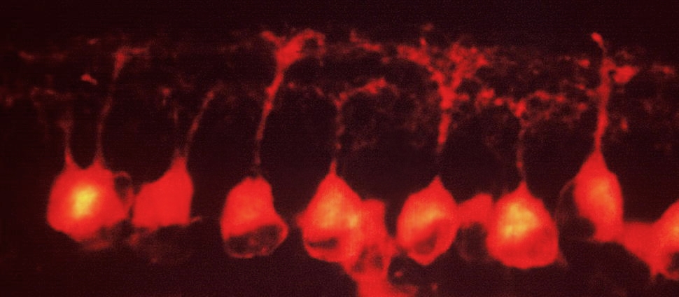 Image of retinal ganglion cells